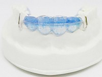 New Design of Smart Retainer