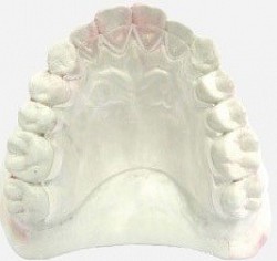 Retainer Color SDA01 ขาวใส