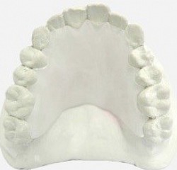 Retainer Color SDA02 ขาวขุ่น